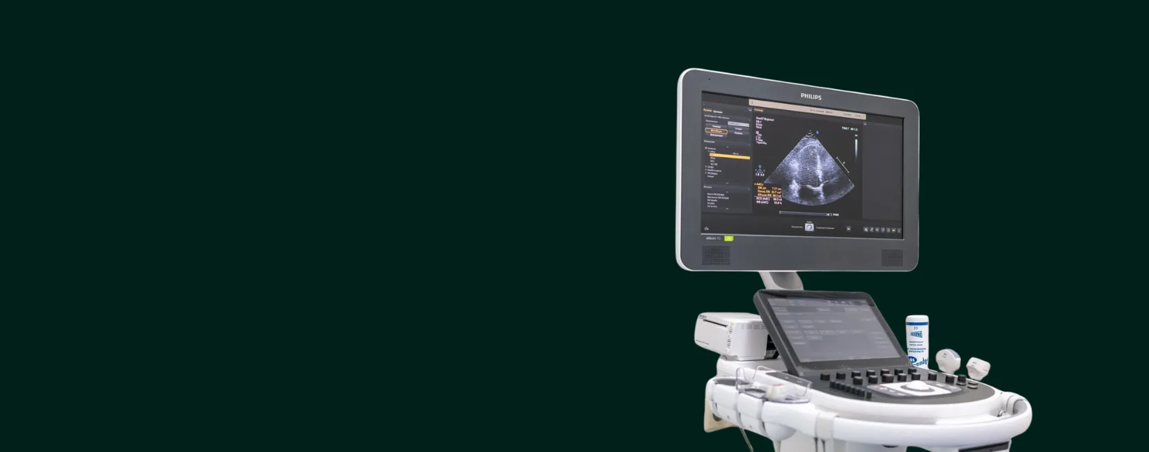 Expert ultrasound
