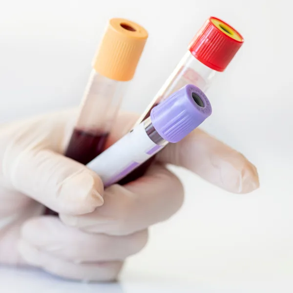 Lab tests in Northport